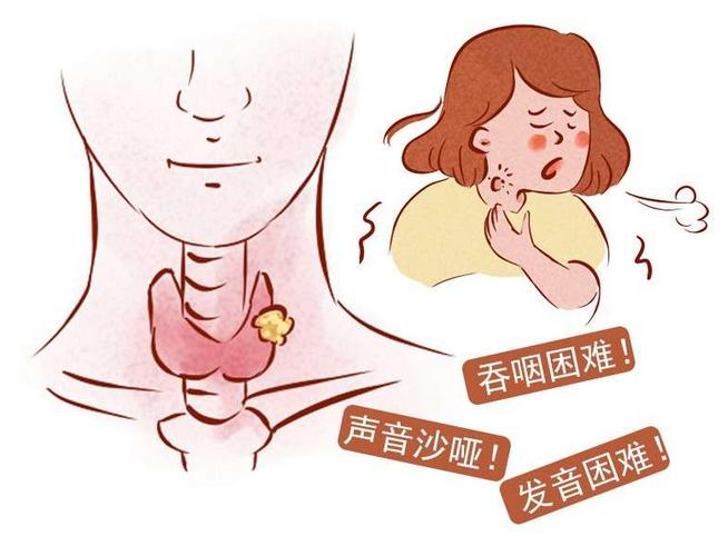 體檢時發(fā)現(xiàn)甲狀腺結節(jié)怎么辦？