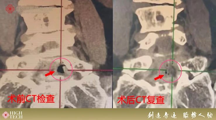 腳痛、坐立不安？這項(xiàng)治療可以助你恢復(fù)活力