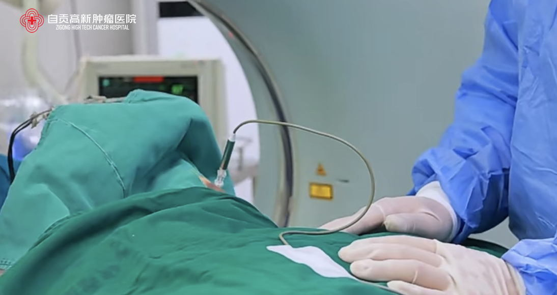 無(wú)需開(kāi)刀的手術(shù)，你了解嗎？