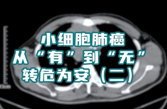 小細(xì)胞肺癌患者，縱隔淋巴結(jié)腫大，情況危急。通過(guò)介入綜合治療，病灶已基本消失